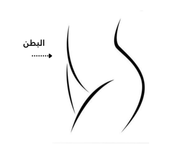 تشققات البطن